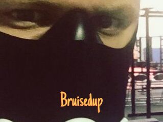 Bruisedup